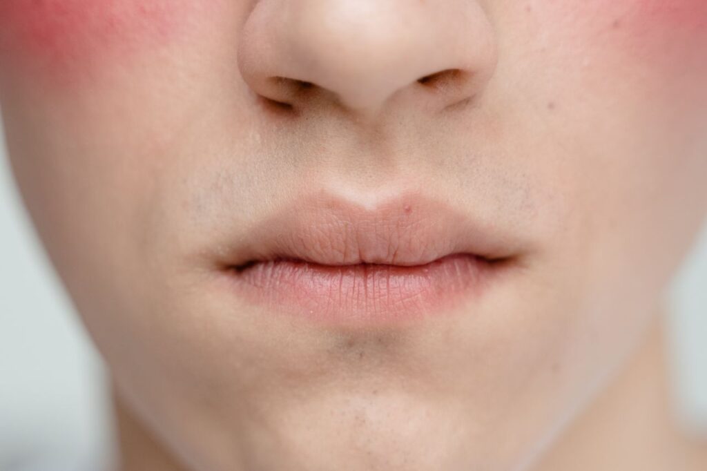 A detailed close-up photo focusing on human lips and skin texture.